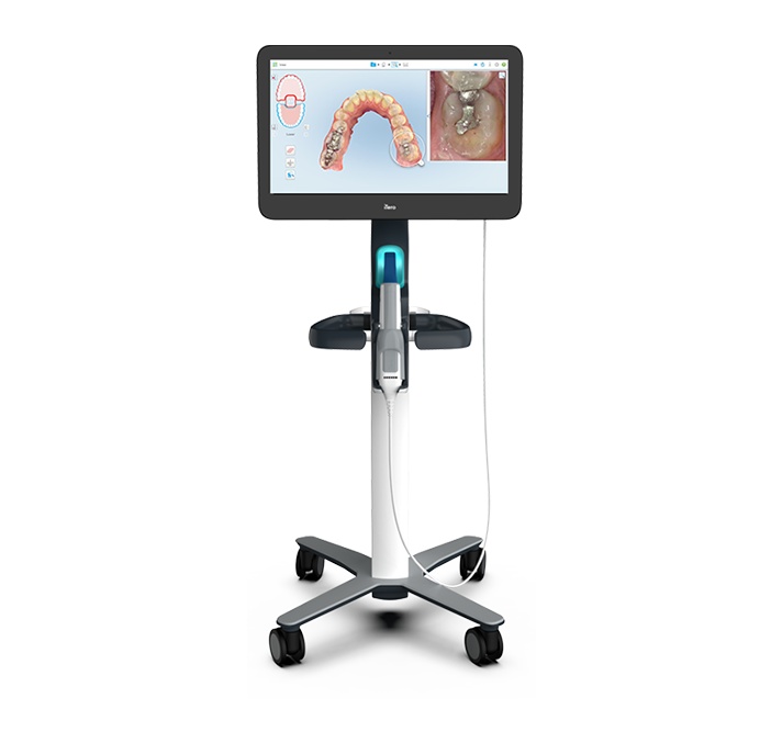iTero orthodontics machine